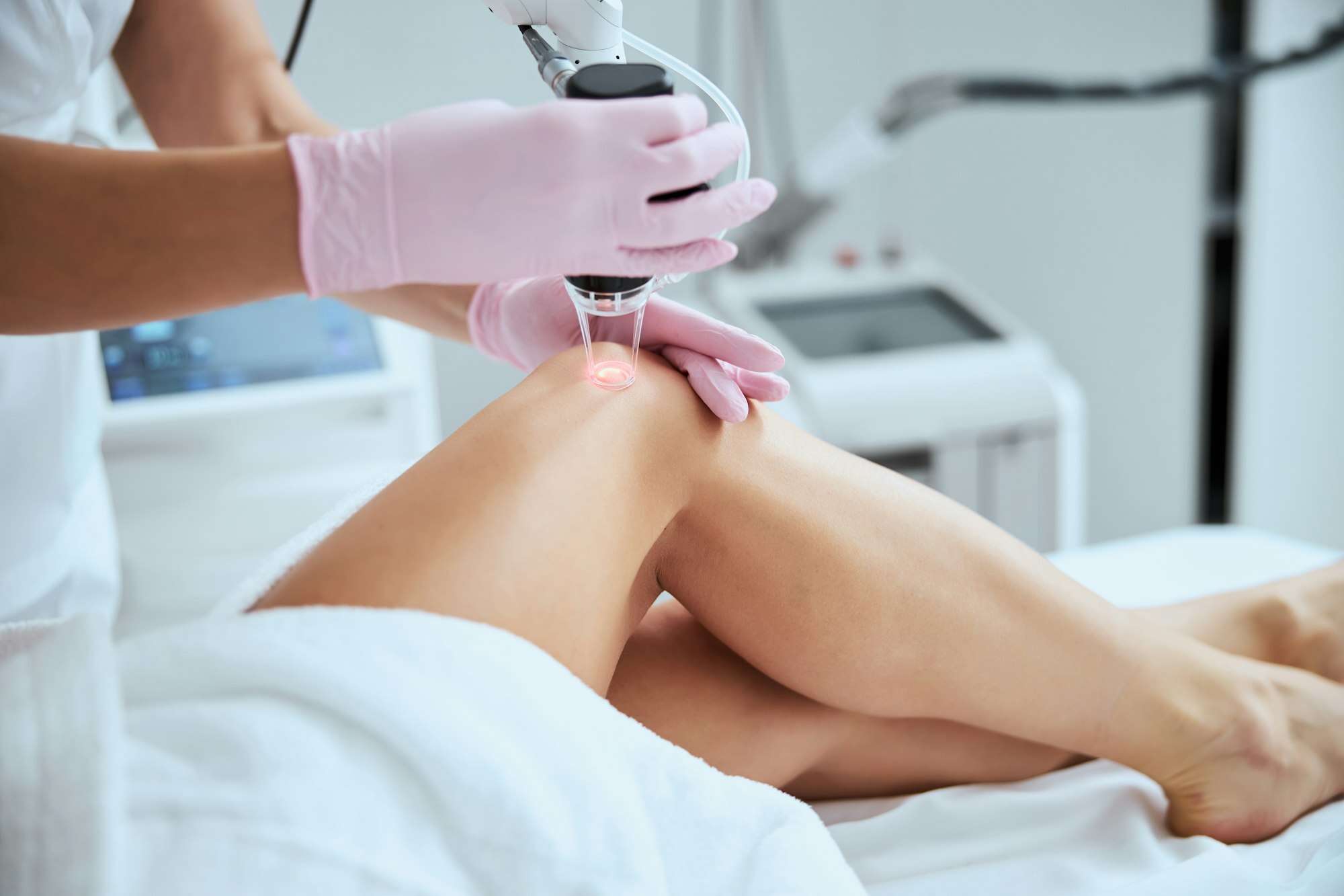 Female client undergoing the laser vein treatment